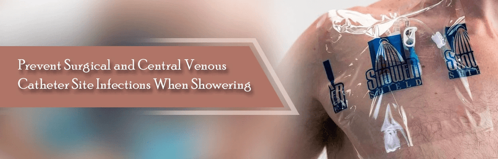Ostomy Shower Cover 101: What You Need To Know