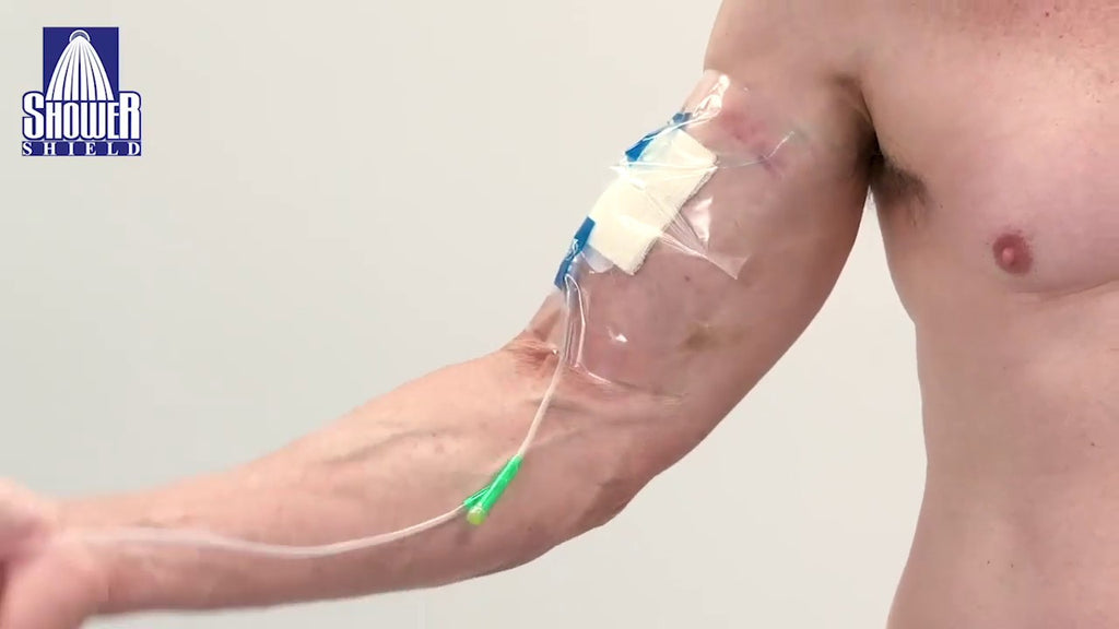 Things To Keep In Mind When You or A Loved e Has A Hickman Catheter Things To Keep In Mind When You or A Loved e Has A Hickman Catheter