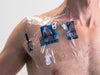 PICC Line Shower Cover by Shower Shield